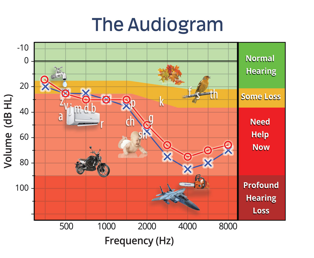 Understanding your Audiogram | Australian Audiology Services - Gold ...